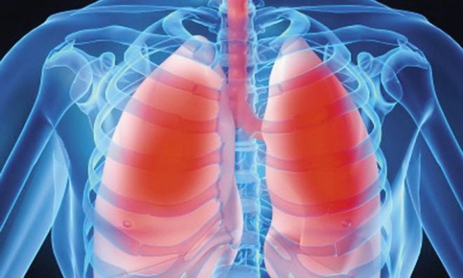Шепетівщина -  одна з лідерів по захворюваності населення на туберкульоз