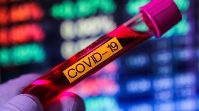 За сьогодні у Шепетівці вже виявлено 5 нових хворих на COVID-19