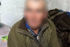 У Полонному чоловік через ревнощі побив співмешканку: у неї зламаний лікоть