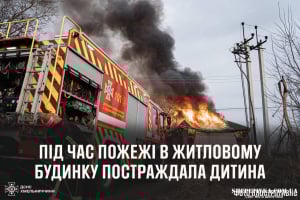 На Шепетівщині під час пожежі постраждала дитина