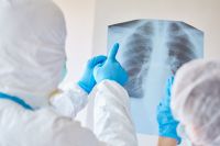 COVID-19 на 13.02.2021: інфікувалось -127, одужало - 148, померло -4