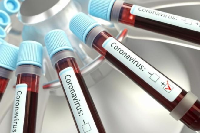 Шепетівщина має вже десятого інфікованого коронавірусом SARS-CoV-2