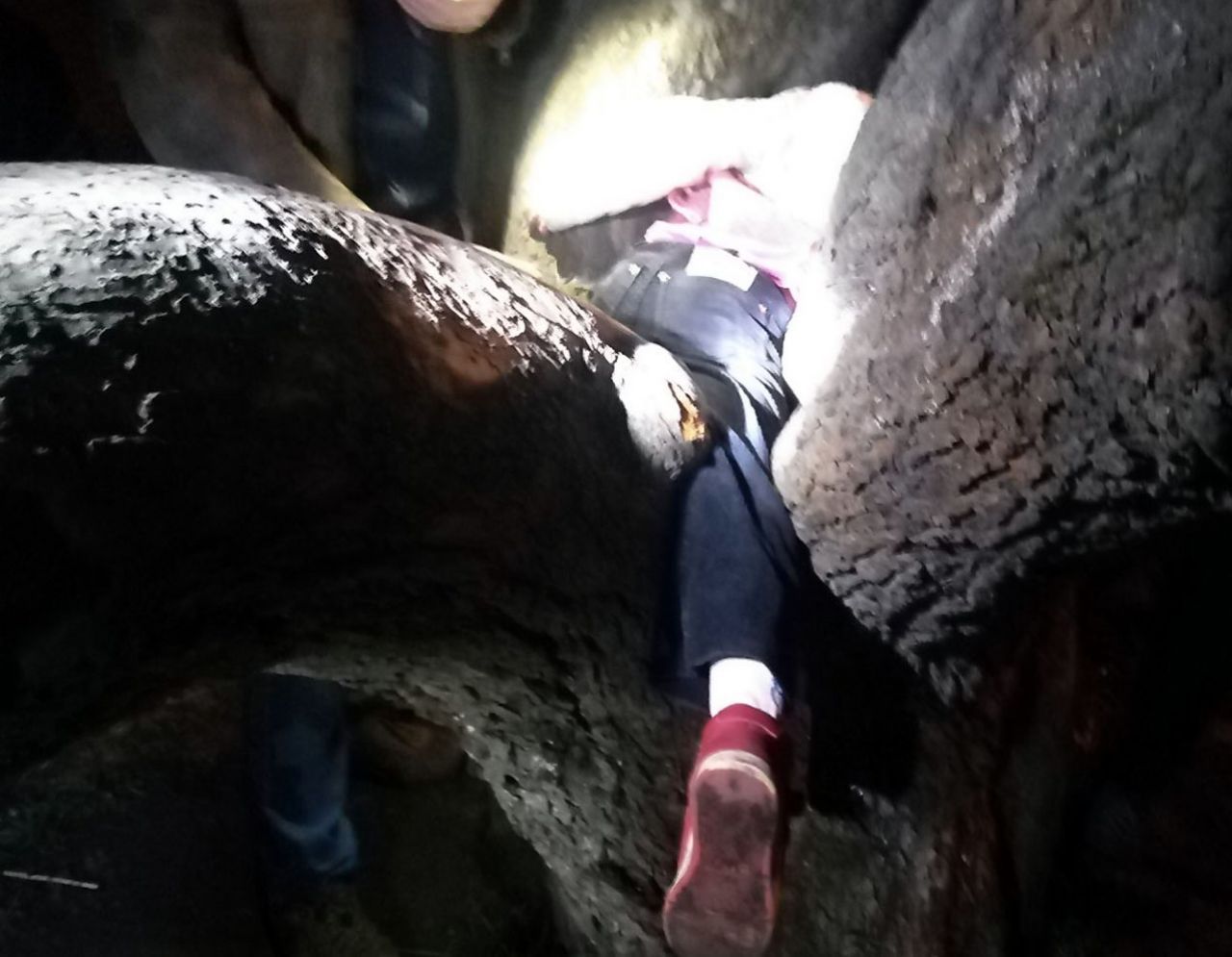 У Шепетівці рятували 5-річну дівчинку, нога якої застрягла між стовбурами дерева