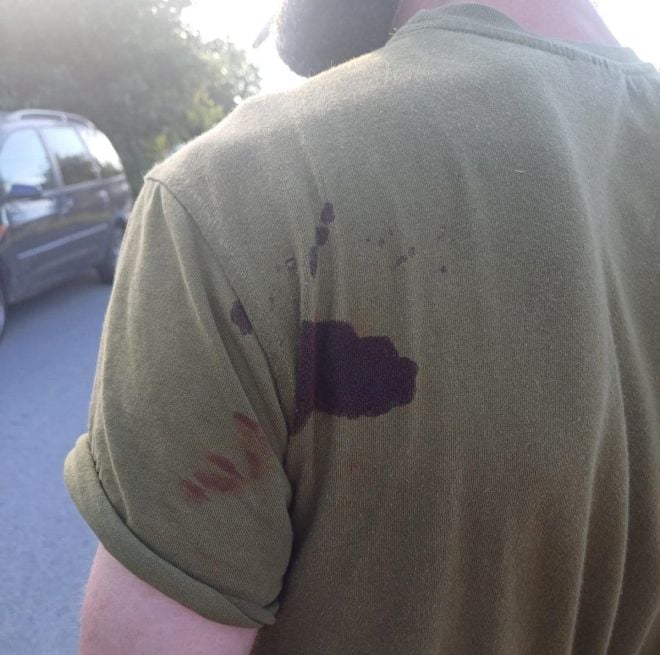 На Хмельниччині чоловік напав на працівника ТЦК із ножем