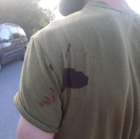 На Хмельниччині чоловік напав на працівника ТЦК із ножем