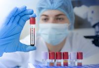 На Шепетівщині через COVID-19 померла одна людина