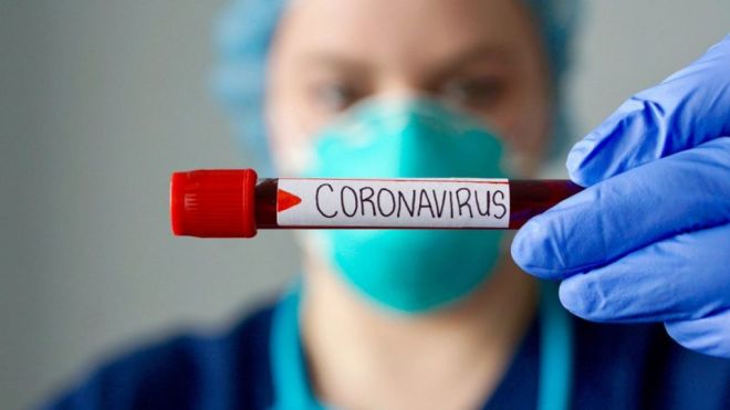 У Шепетівці ще вісім інфікованих коронавірусом