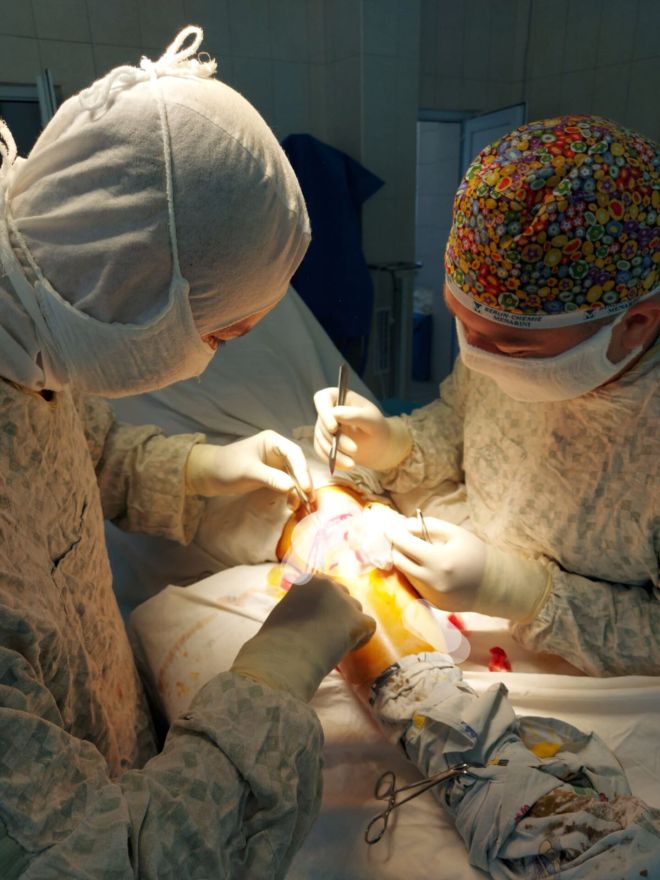 У Шепетівці вперше виконали унікальну операцію на коліні