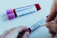 COVID-19 на 19.05.21: нових інфікованих - 178, одужало - 702, летальних випадків - 8