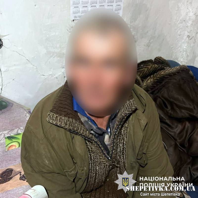 У Полонному чоловік через ревнощі побив співмешканку: у неї зламаний лікоть