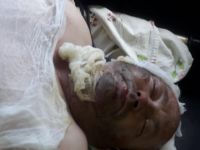 Батько отримав важкі травми внаслідок ДТП. Допоможіть!