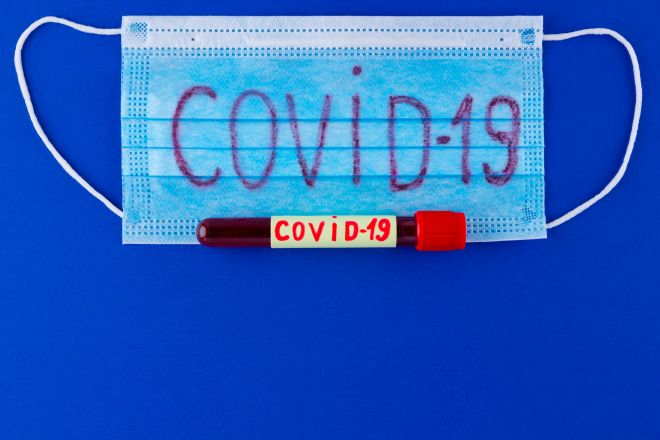 COVID-19 на 17.04.2021: інфікованих - 644, одужало - 618 та 8 померло