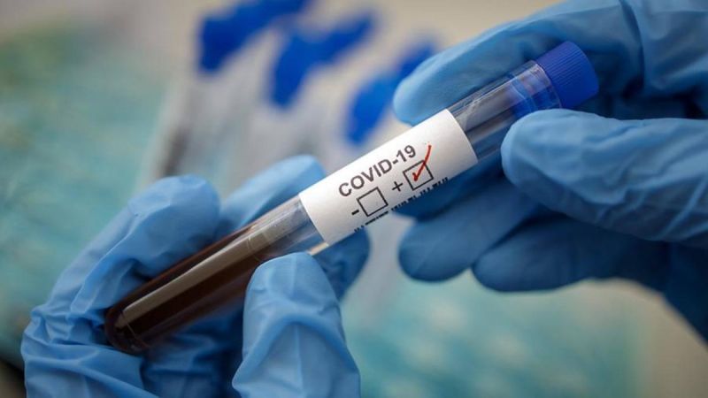 COVID-19: 184 нових інфікованих у області та 9 у Шепетівці