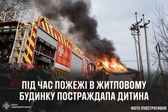 На Шепетівщині під час пожежі постраждала дитина