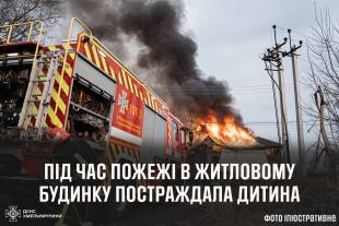 На Шепетівщині під час пожежі постраждала дитина