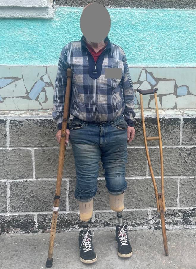У Шепетівській виправній колонії засудженого забезбечили протезами