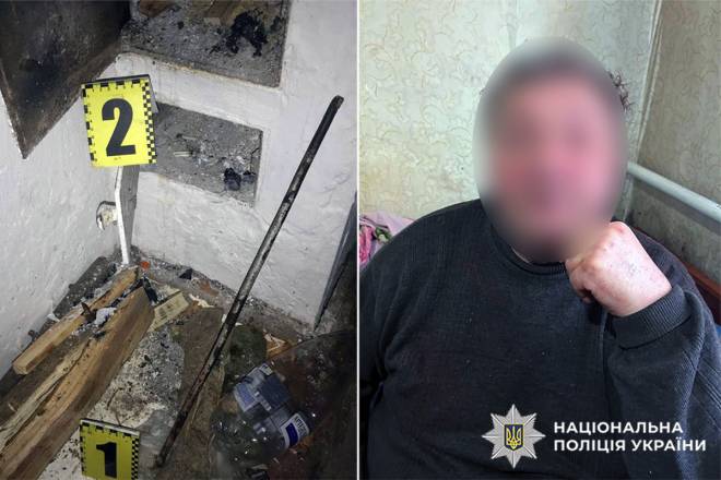 На Шепетівщині чоловік бив дружину дерев’яним брусом та металевим прутом