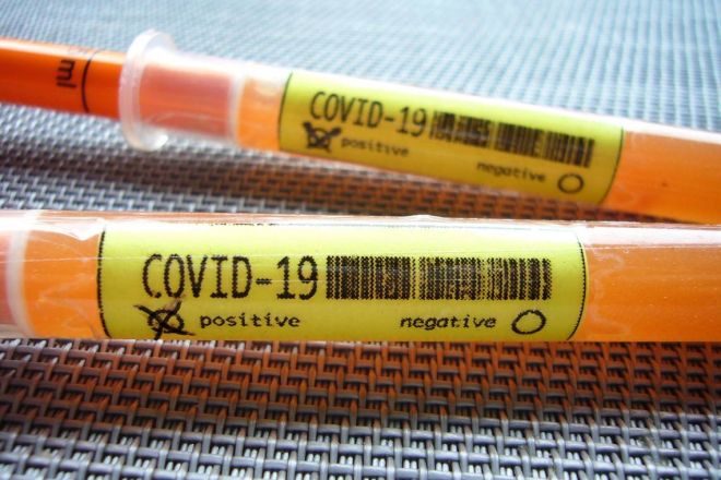COVID-19: 248 нових інфікованих, 2 смерті та 58 одужавших