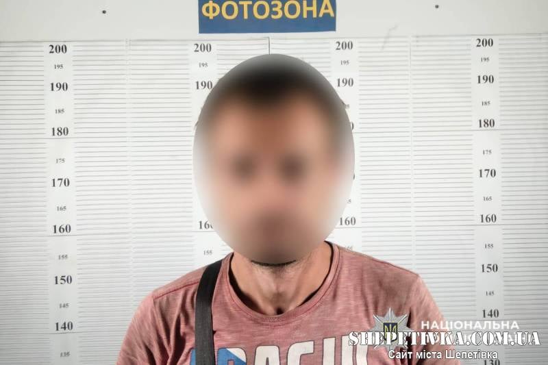 Побив дружину до тяжких травм — поліція оголосила підозру жителю Шепетівки