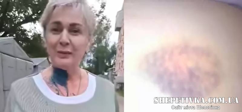 Обливав зеленкою та погрожував спалити: після розголосу оголосили підозру 53-річному домашньому тирану
