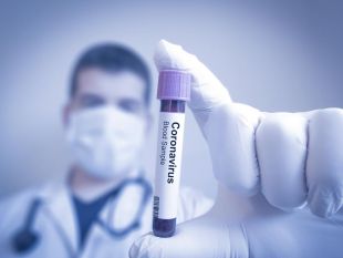 Приватна клініка підтвердила 69-ий випадок інфікування шепетівчан SARS-CoV-2