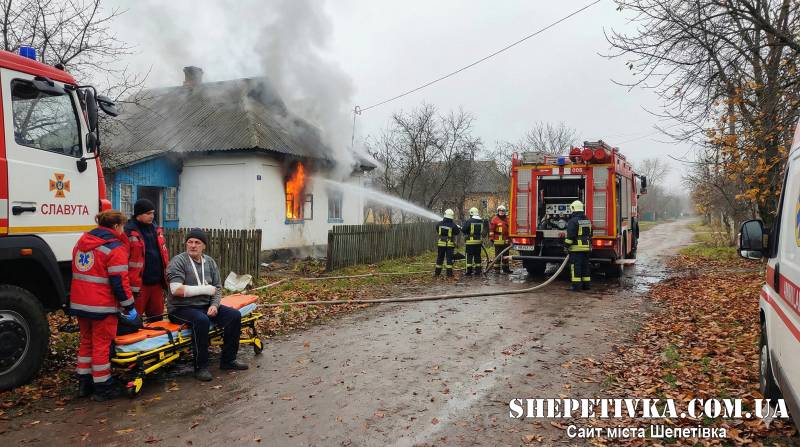 У Славуті горів житловий будинок, травмувався чоловік
