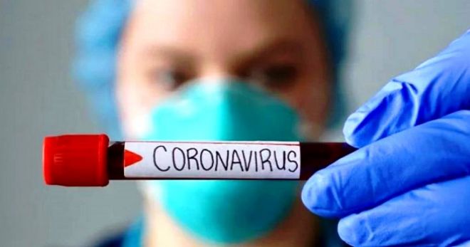 COVID-19 на 30.01.2021: нових інфікованих - 123, одужало - 175 та померла 1 особа