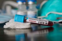COVID-19: нових інфікованих у Шепетівці - 27, у області - 192 та 6 летальних випадків