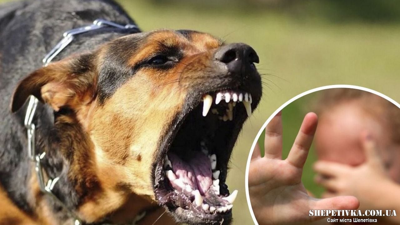 Ледве не відкусили дитині палець: у Шепетівці почастішали напади безпритульних собак